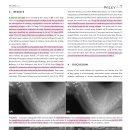 tracheal collapse와 단두종 및 인후두 motion과의 관계 이미지