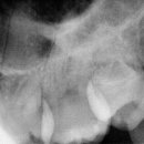 첫사랑니치과의원 이미지