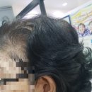 해운대독일보청기 이미지