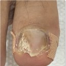 아우룸네일 이미지