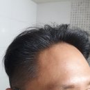 비오티아 샴푸 사용 후기, 탄산스케일링으로 탈모 관리!