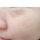 닥터하스킨 이미지