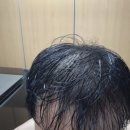 주식회사 장가 | 닥터오레고닌 탁시폴린플러스샴푸 사용 후기, 장민호샴푸로 탈모샴푸추천!