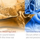 서울난청센타 이미지