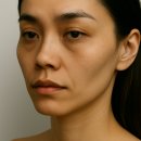 다산종합의원 | 다산역피부과 스컬트라 관리, 후기와 효과는?