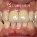 종로크라운 이미지