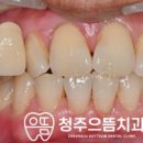 청주으뜸치과의원 이미지