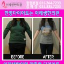 이레생한의원 네이버블로그