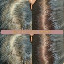 뷰티호텔 이미지