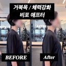 오리역 헬스장 거북목 체력강화 비포 애프터 개선 사례 공개