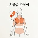 미쯔이식 주열 | 암3기 생존율 80% 확률로 낫는다/미쯔이 온열기 유방암 주열법