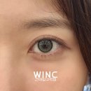 하늘빛투 이미지