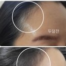라벨라헤어 이미지