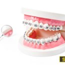 죽전 에스라인치과의원 이미지