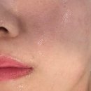 풍암한방병원 | 광주 풍암동 관리 - 광주 풍암동 바디관리 얼굴관리 받고 온 후기 &#34;살빼몸빼빼빼&#34;