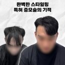 블랭크유 - 제주시 | 한올증모 실패 후 선택한 블랭크유 증모술 성공적 후기