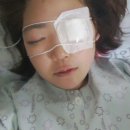 토릭 ICL(렌즈삽입술) 후기 (스압주의!) +수술한병원,비용추가 이미지