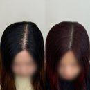 라니네세탁 | [쌍촌동 두피문신] 칼가르마 두피교정, 르니뷰티 후기