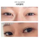 뷰티클리닉화장하는여우 | 서면속눈썹연장 시리뷰티 - 정확한 위치와 클래식연장 비포애프터 후기