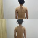 샤인스톤 | [청주 피부관리] 복대동 샤인스킨케어 뱀부테라피 등관리 40분 솔직후기 !