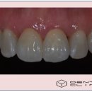 동의치과기공소 이미지