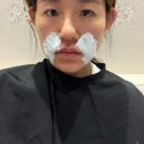 [홍대 미희주사 후기] 깊어가는 팔자주름 차오르는 효과!