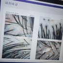 [송도두피관리] 닥터모락 송도점, 캠퍼스타운역두피케어 솔직 후기!