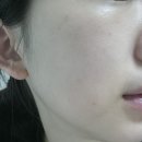 가나약국 | 레디영 약국 화장품 쥬비렉스 PDRN : 사용후기
