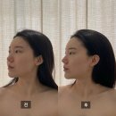 리즈뷰티엔해독센터 | [부산/연산동에스테틱] 로하스 윤곽전문센터 연제점_시그니처 윤곽관리 후기 #전후사진 #통증없는