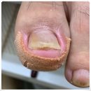 안양내성발톱 관리 실력 뛰어난 곳 미엘네일 페디크루 안양점