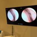 소화의원 | 철결핍성빈혈 검사 후기 | 페리틴 수치 생각보다 낮았던 내 상태 (용산 더우아의원)