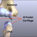 주관절(Elbow) Ⅰ. 이미지