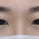 윈썸브로우 이미지