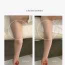 이코웨이브에스테틱 - 제천시 신죽하로 39 | '운동으로도 안 빠지던 팔뚝, 라인이 달라졌어요.'이코웨이브 에스테틱 팔 라인 관리 후기