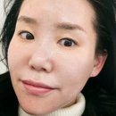 김해피부관리 잘하는곳 '더밝음메디에스테틱' 찐 후기