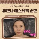 팔금당 | 순천피부관리·금당혼주관리 추천! | 유앤나 에스테틱 순천 | 물방울리프팅 1회 관리 솔직 후기