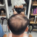 김호증모가발다온헤어