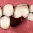 연세세브란스치과의원 이미지