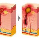 아그네스 통상 이미지