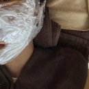 라라라뷰티 | 트윈픽셀(TWINPIXEL) 니들RF 포텐자 업그레이드 버전 (후기/가격/통증/압구정로데오피부과)