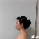 감삼동317 | 청아피부체형관리실에서 두골비 안면 비대칭 관리받은 후기