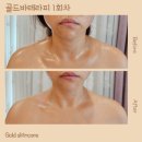 골드스킨&바디 이미지