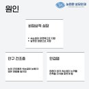 눈편한성모안과의원 네이버블로그