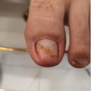 내손톱내발톱