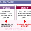 부산의사신협의료기 | 유방절제술 후기 (1편) (43세, 섬유상피성병변 2.5cm, 부산대학병원)