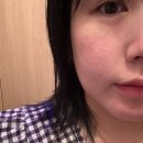 탈리타쿰 | 탈리타쿰 에센스 수 사용 후기｜민감성 피부도 안심한 천연 보습 에센스의 힘