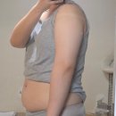 경남수의동물병원 | 창원다이어트병원 팔뚝 복부 제로팻주사후기 2회차 솔직후기