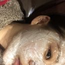 아셀 | 청담 피부과 쥬브아셀 후기 강남 피부과 내돈내산으로 남겨보는 솔직 후기