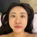삼전역 피부관리 올가드림뷰티 삼전역점 관리받은 후기