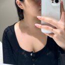 다빈치의원 | 압구정 온다리프팅 :: 에이포의원에서 온다리프팅 6만줄 받은 후기
